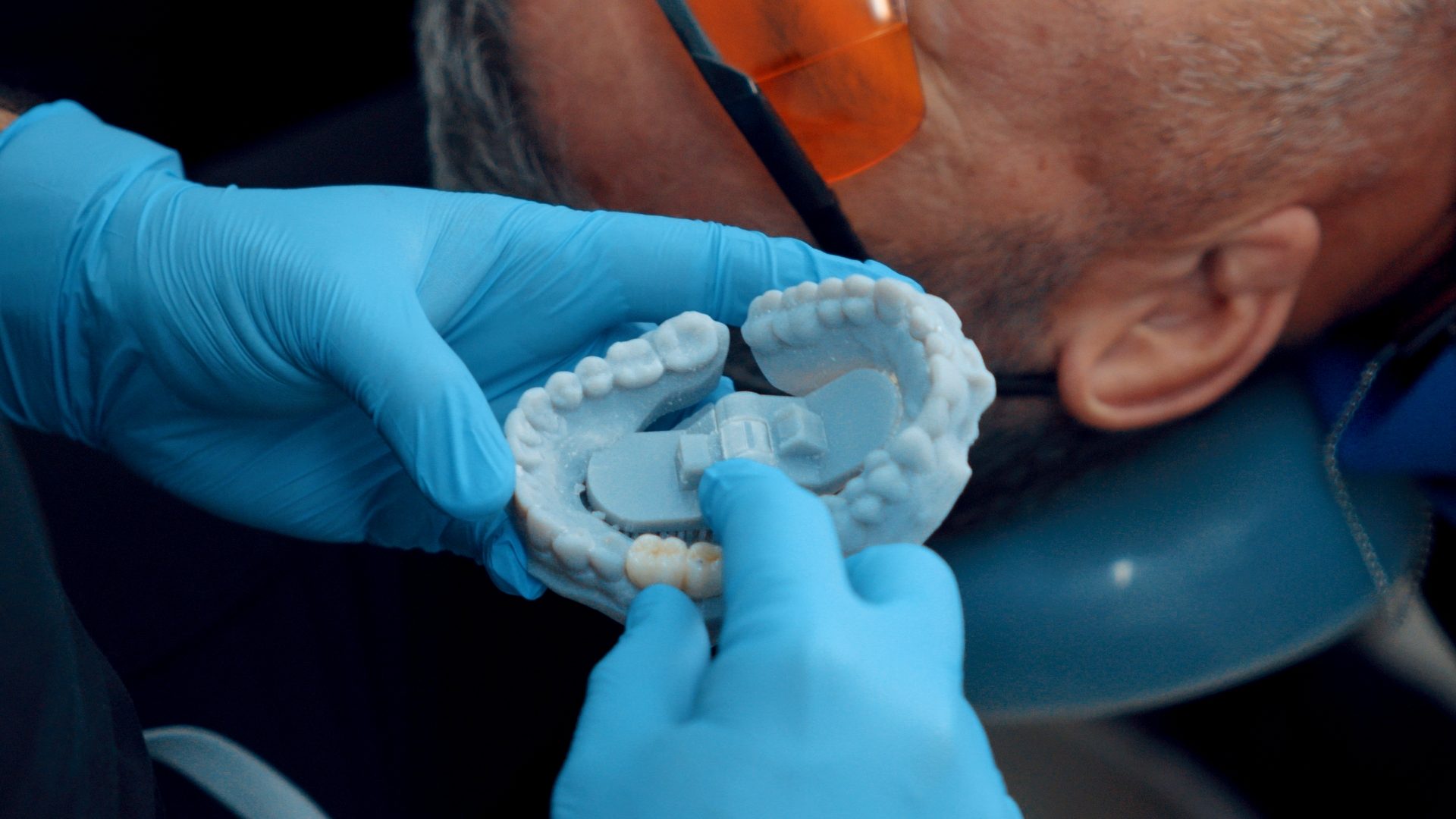Dentist holding a 3D dental model while planning biological veneers for a patient